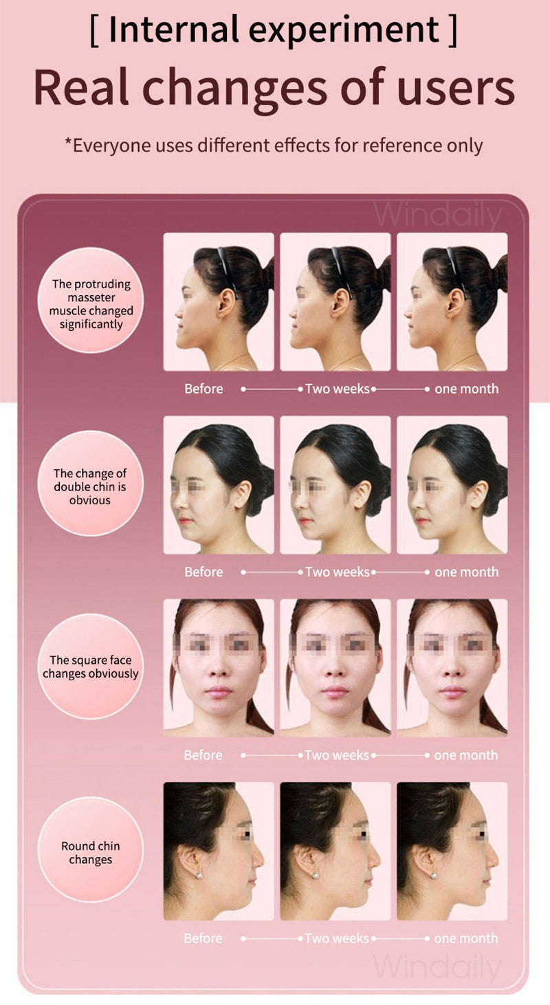 Dispositivo de elevación Facial terapia de fotones LED masajeador de vibración a